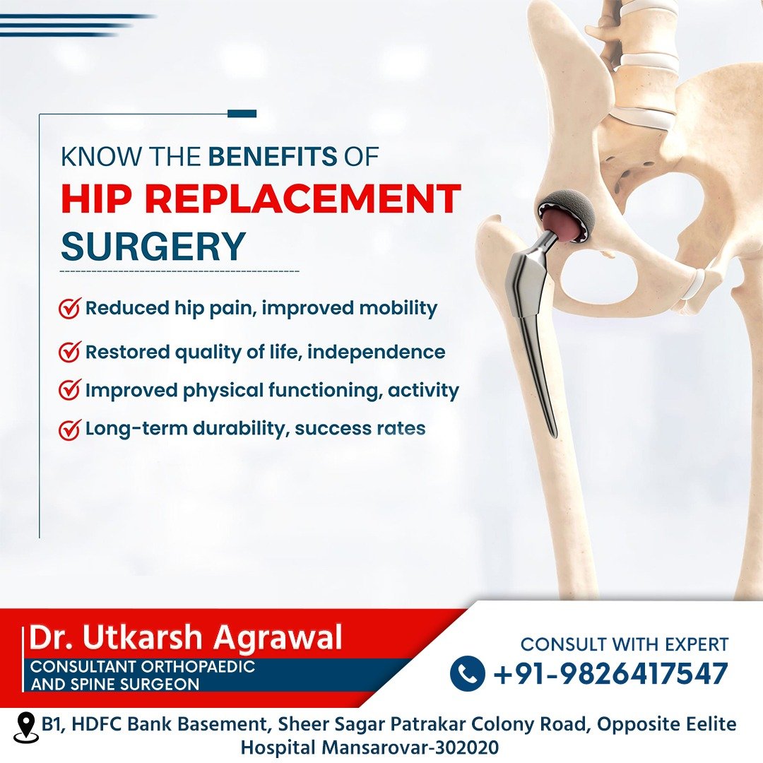 Know the Life-Changing Benefits of Hip Replacement Surgery